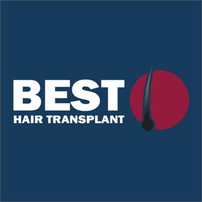 Best Hair Transplant